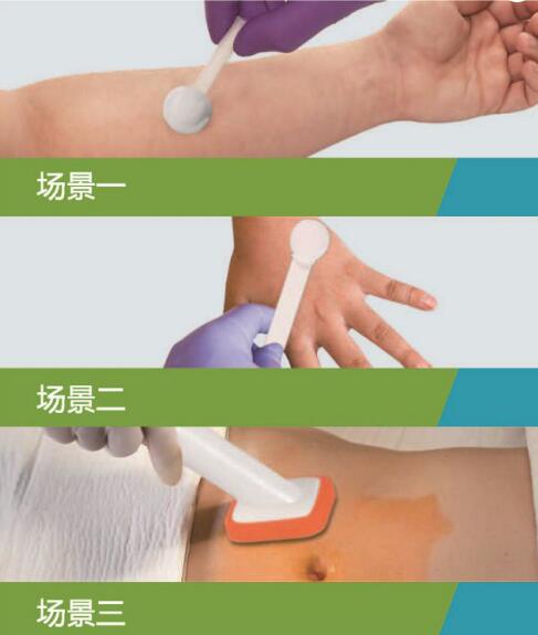 洗必泰消毒涂药器的场景应用